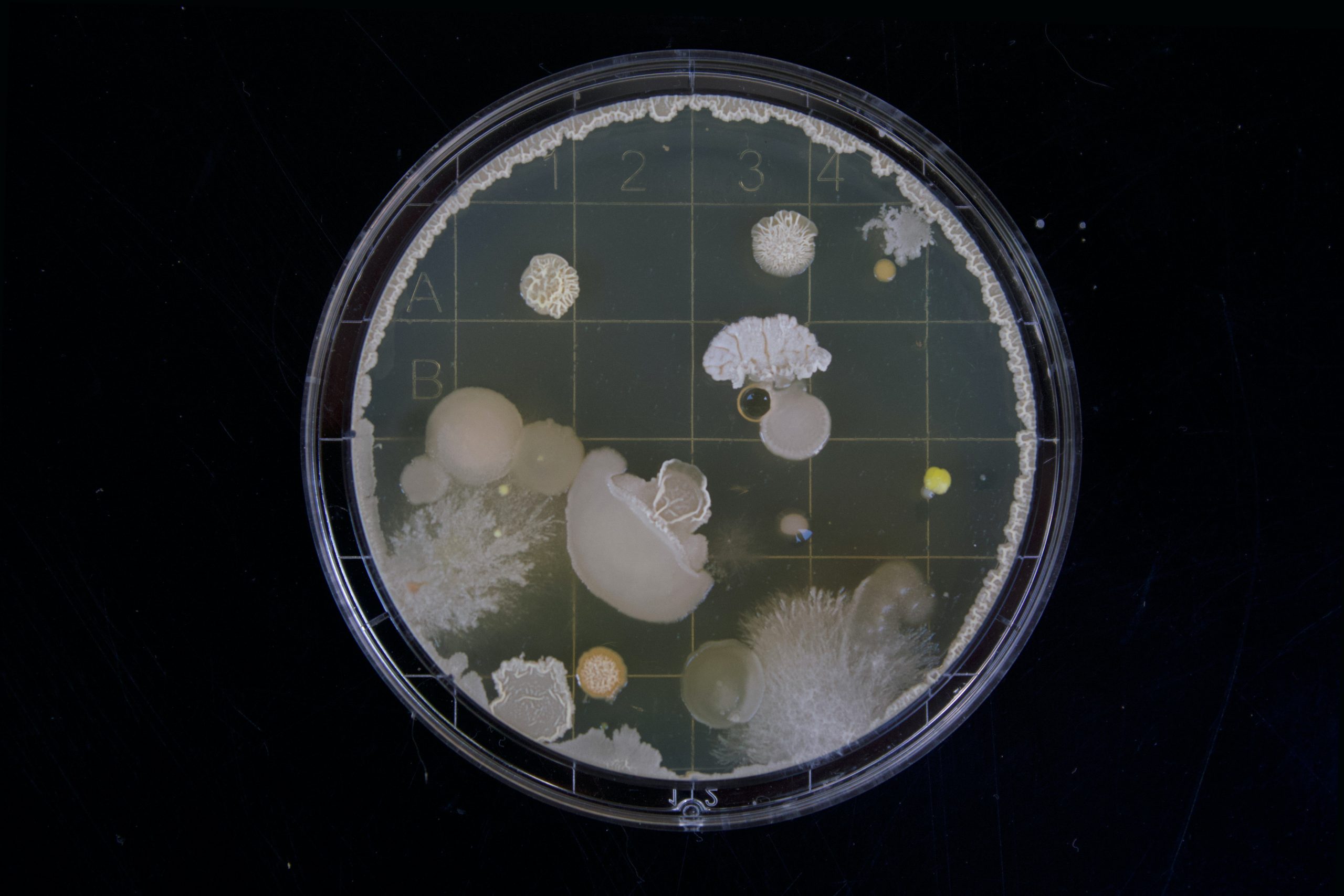 Je bekijkt nu E.coli: wat is het en wat zijn de gevaren?